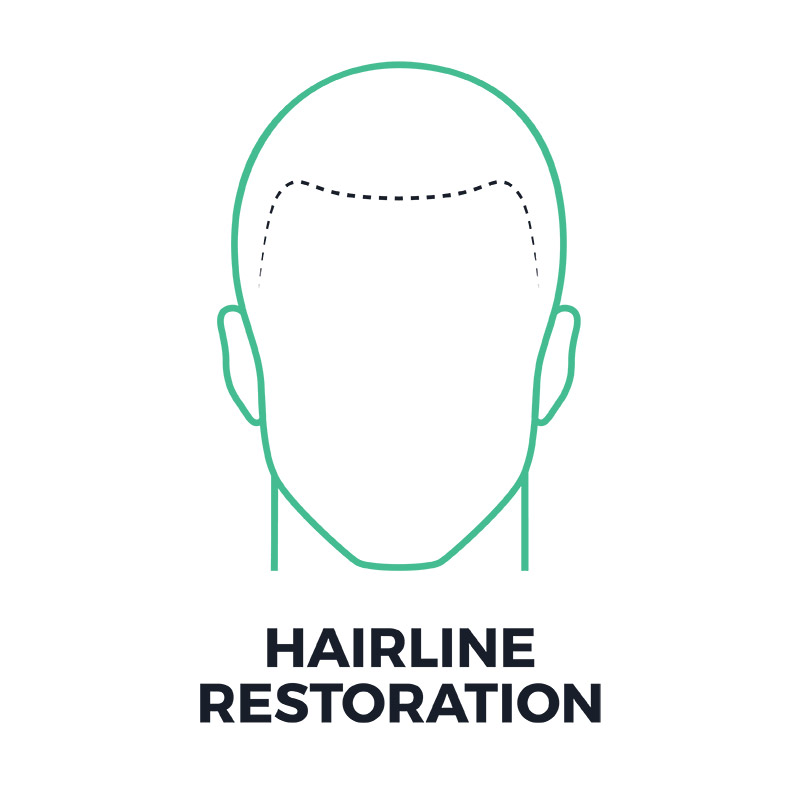 smp-hairline-restoration-smpflorida